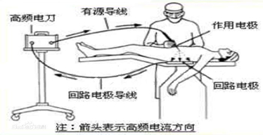 有源器械和無(wú)源器械是什么？解釋來(lái)了，給我碼住！